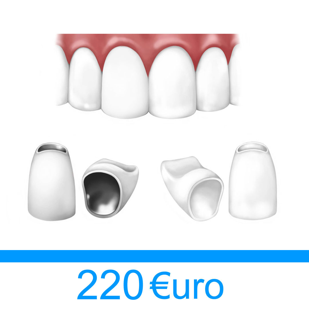 corona dentale in ceramica